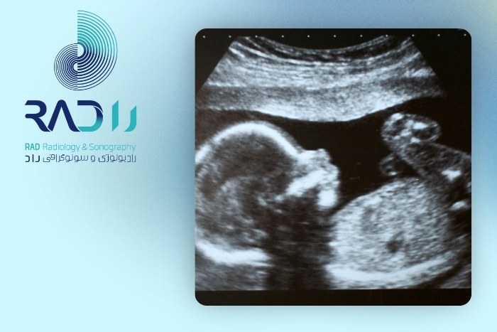 نکاتی برای آمادگی قبل از اولتراسوند