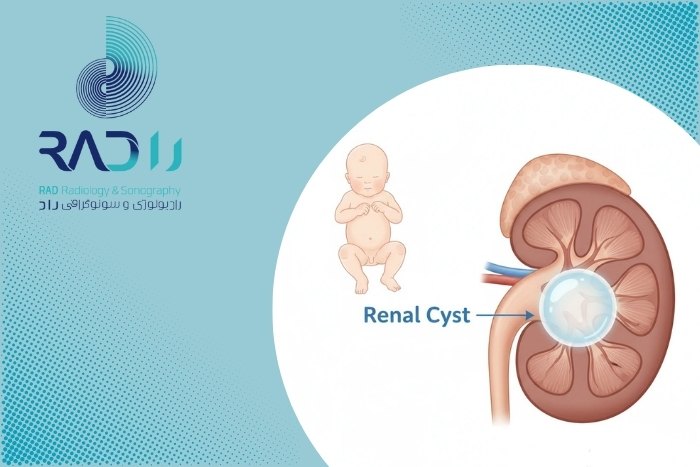 آیا کیست‌ های مادرزادی کلیه در نوزادان خطرناک هستند؟