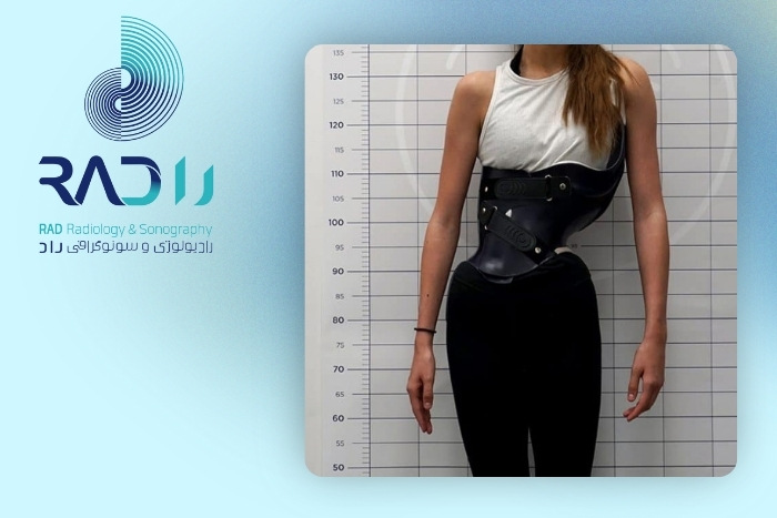 اقدامات بعد از تشخیص