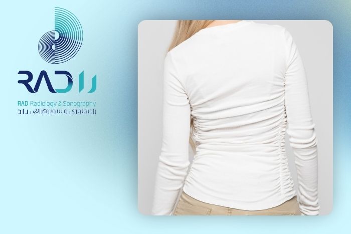 انواع اسکولیوز
