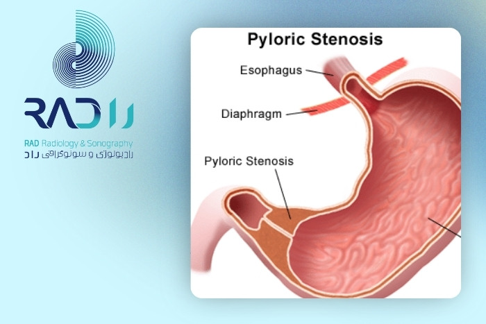 اهمیت تشخیص به‌موقع