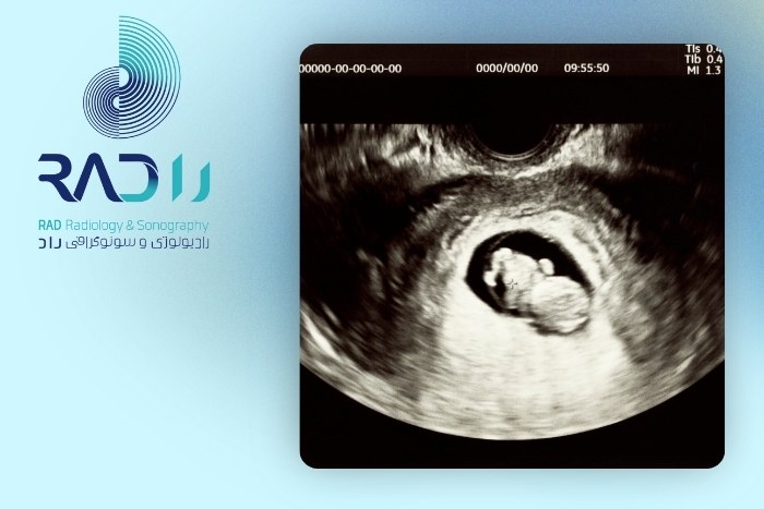 اهمیت سونوگرافی بارداری