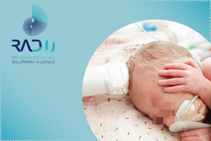 چرا انجام سونوگرافی مغز در نوزادان نارس اهمیت بیشتری دارد؟