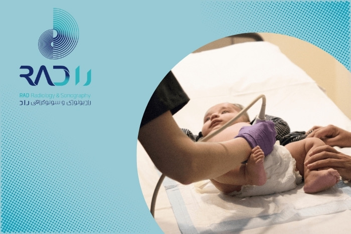 بهترین زمان برای انجام سونوگرافی لگن نوزادان چه موقع است؟ بهترین زمان برای انجام سونوگرافی لگن نوزادان چه موقع است؟