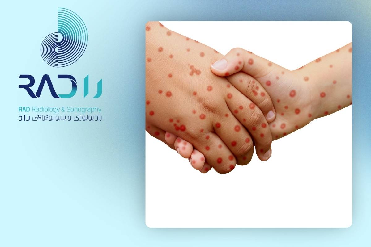 بیماری‌های زمینه‌ای