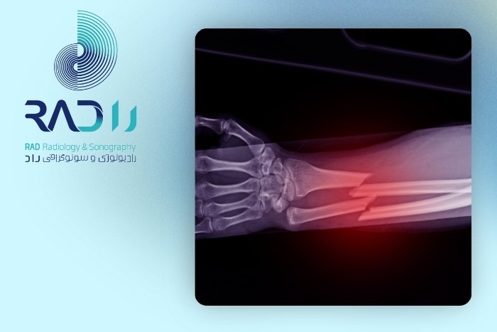 چطور بفهمیم بهبود کامل یافته‌ایم؟
