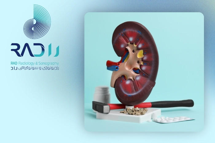 تشخیص سنگ کلیه با سونوگرافی یا سی‌تی‌اسکن
