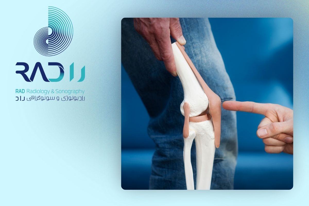 مزایای سونوگرافی در تشخیص پارگی تاندون