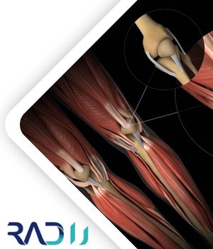 نقش سونوگرافی در روند درمانی پارگی تاندون