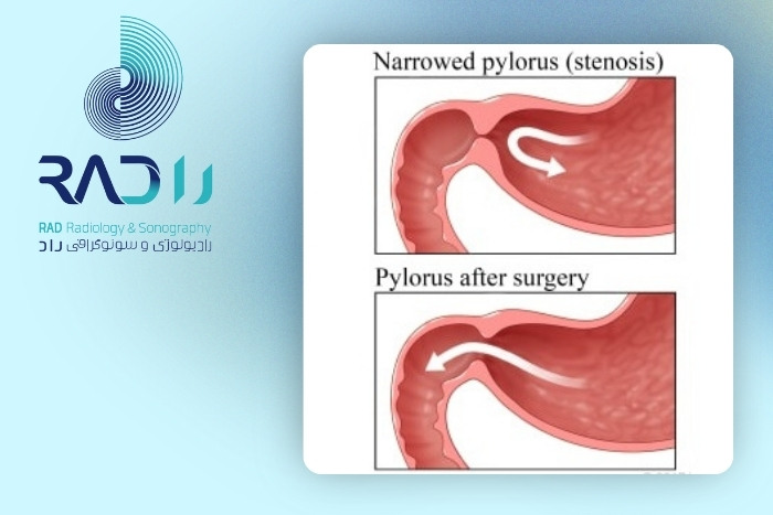 راه‌های تشخیص