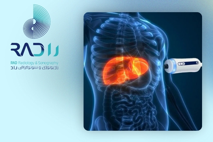 سایر روش‌های تشخیص