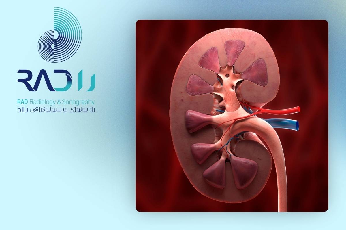 روش‌های پیشگیری از کیست کلیه