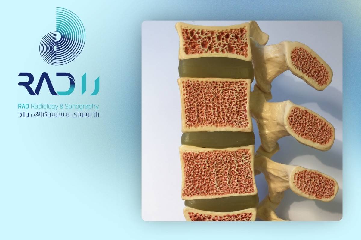 روش‌‌های پیشگیری از پوکی استخوان کودکان