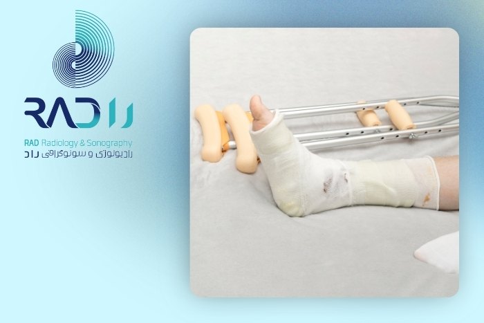 روند کلی بهبود شکستگی