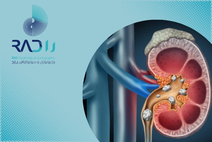 سنگ کلیه با سونوگرافی بهتر تشخیص داده می‌شود یا سی‌تی‌اسکن؟