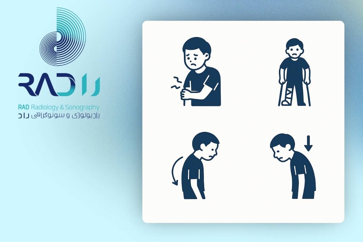 علائم کاهش تراکم استخوان در کودکان