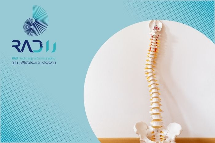 علت اسکولیوز چیست و چه کسانی به آن مبتلا می شوند