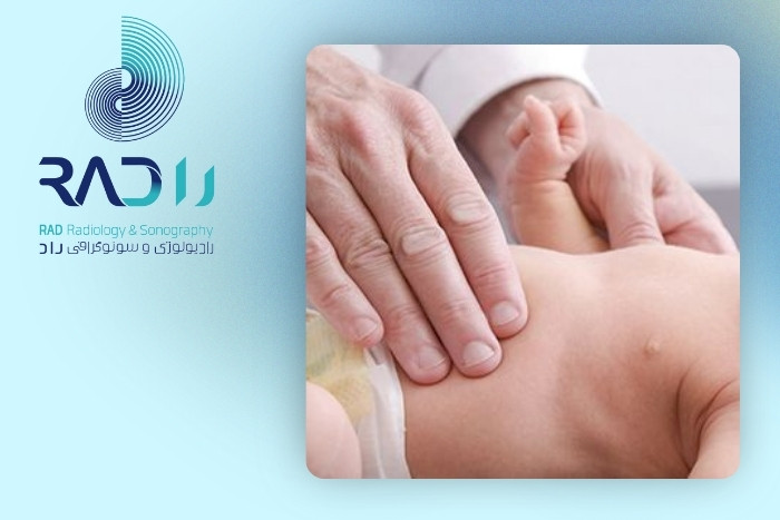 علت ایجاد کیست‌های مادرزادی