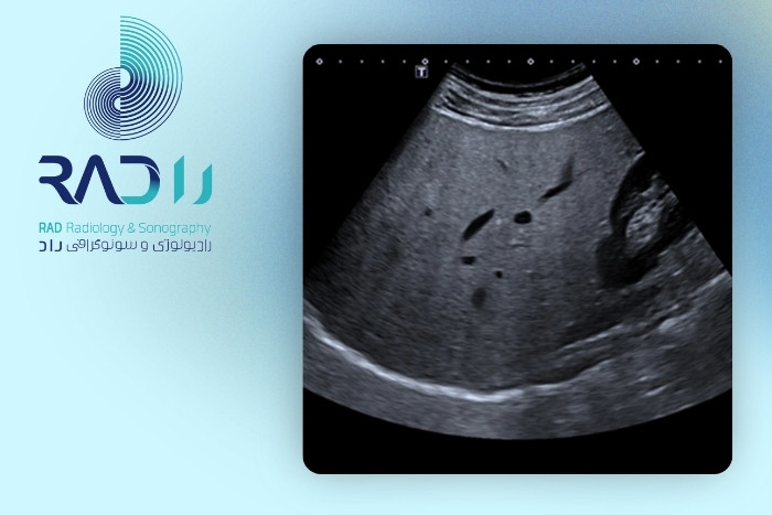 علت پنهان ماندن توده‌های کبدی در سونوگرافی