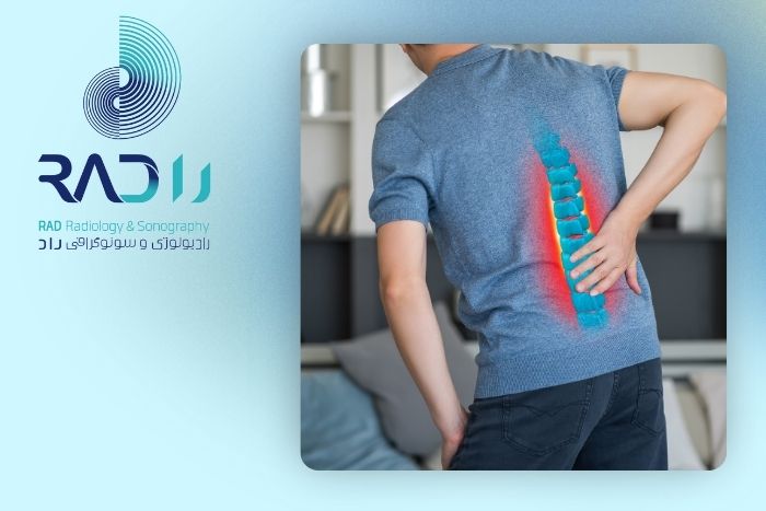 فتق دیسک کمر چه علائمی دارد