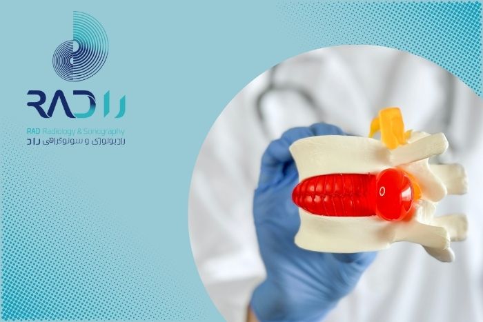 فتق دیسک کمر: علائم، علل و روش‌های درمانی موثر