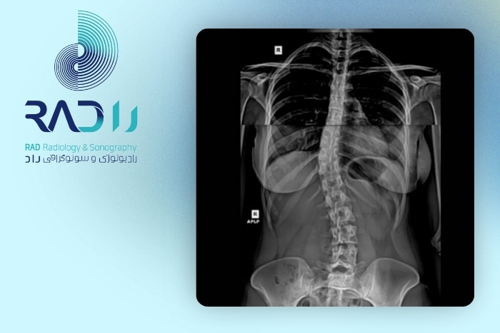 محدودیت‌های رادیولوژی 