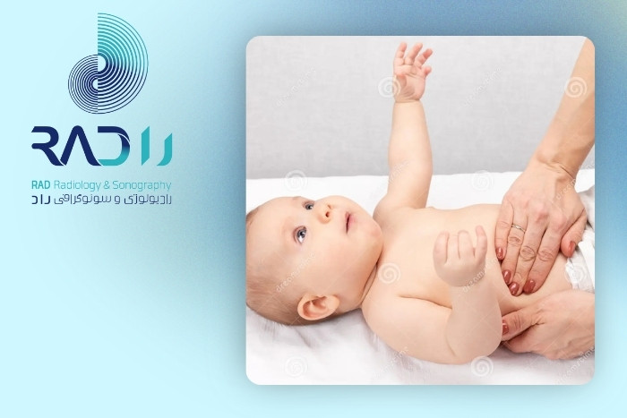 مراقبت‌های نوزاد مبتلا به کیست کلیه