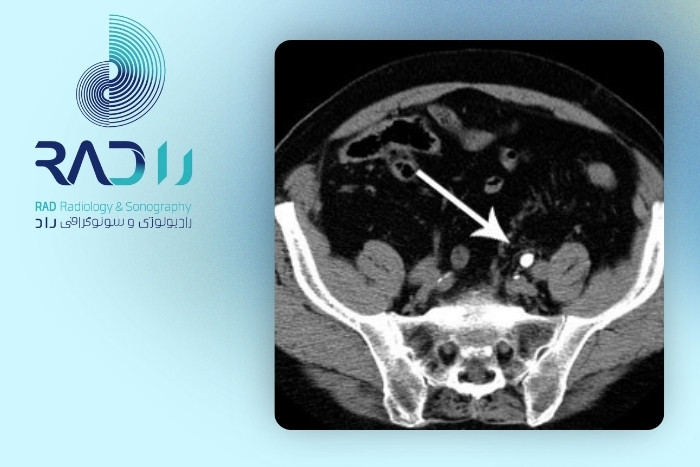 مزایا و محدودیت‌های هر روش