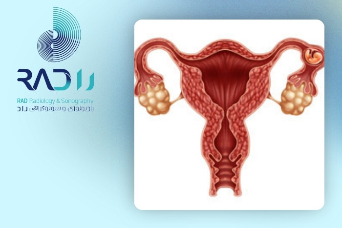اقدامات ضروری برای پیشگیری