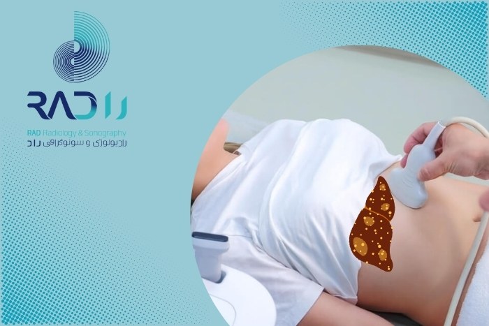 چرا برخی توده‌های کبدی در سونوگرافی دیده نمی‌شوند؟