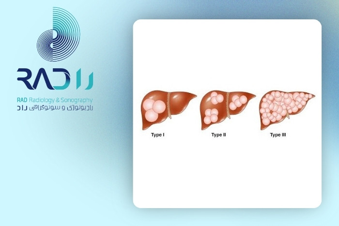 چه زمانی درمان لازم می‌شود؟