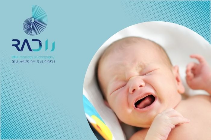 اگر نوزادم کولیک یا رفلاکس معده داشت چیکار کنم؟ اگر نوزادم کولیک یا رفلاکس معده داشت چیکار کنم؟