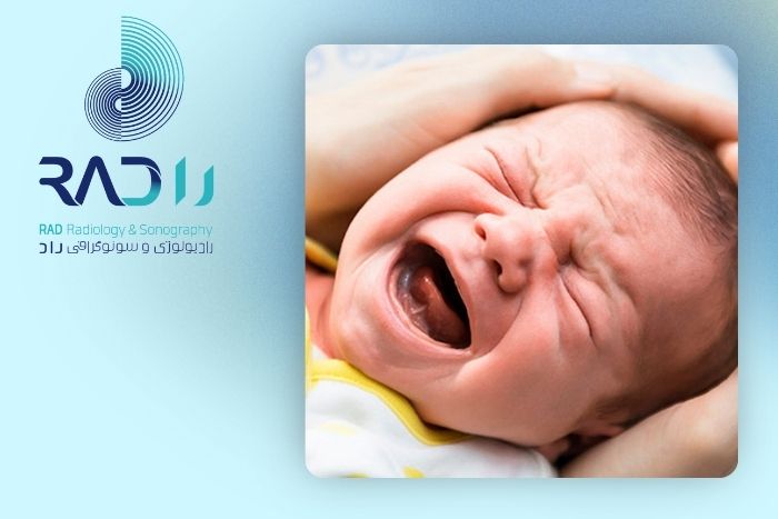 روش های تشخیص رفلاکس و کولیک نوزادان روش های تشخیص رفلاکس و کولیک نوزادان