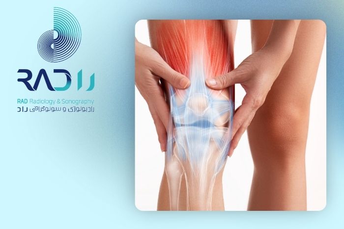 اضافه وزن و پا درد شدید و انحراف زانو اضافه وزن و پا درد شدید و انحراف زانو