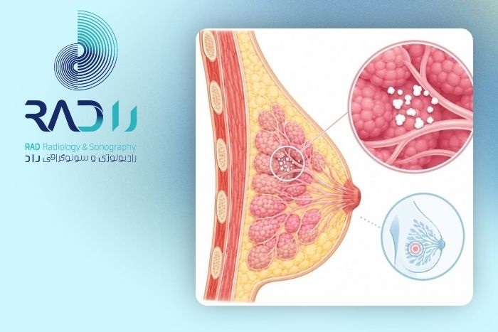 اقدامات پزشکی پس از مشاهده میکروکلسیفیکاسیون
