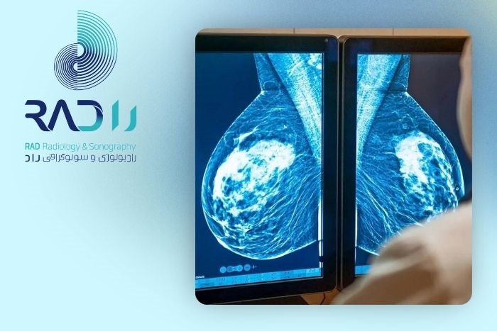 الگوی قرارگیری میکروکلسیفیکاسیون‌ها چگونه ارزیابی می‌شود؟